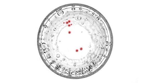Si vous présentez des symptômes de prostatite, vous devriez vous faire tester pour détecter des infections cachées.